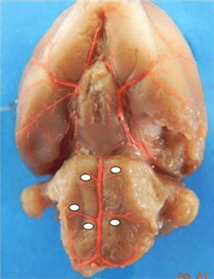 Macroscopic Photography Of A Rat S Brain Base Showing On Both Sides The