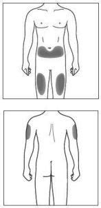 Secuquinumabe Antes E Depois - Cosentyx (Secuquinumabe) 75mg - Bula do paciente | Farmaindex