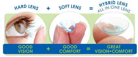 Synergeyes Hybrid Contact Lenses Keratoconus Eyecare Concepts