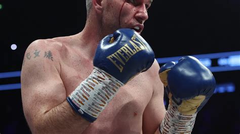 Liam Smith shows off horror cut above eye after ten-round beatdown by ...