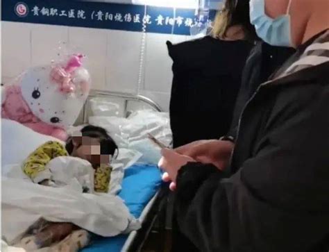 4岁女童被殴打病危，双腿烫伤险要截肢！生父和女友被刑拘女童遭虐待双脚烧伤 生父继母被刑拘被虐待烫伤的女童腿保住了燕燕