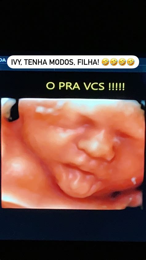 Foto Filha De Thaeme Mari To Faz Careta Em Ultrassom Hiper Realista