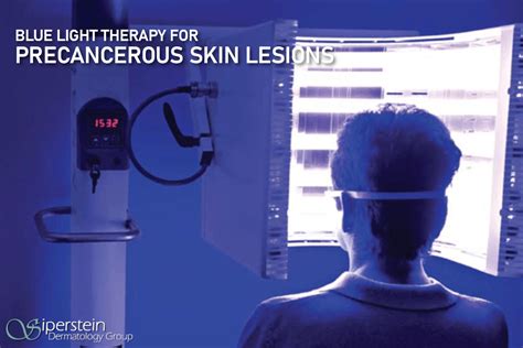 FAQs About Blue Light Therapy For Precancerous Skin Lesions