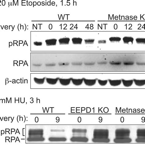 Metnase And EEPD1 Differentially Regulate DDR Signaling A WT And