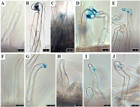 Symbiotic Phenotypes In Primary Infection Of M Truncatula A17 A E