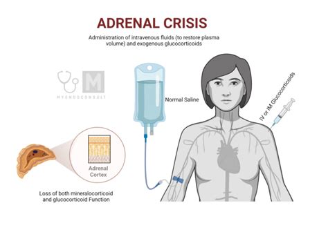 Adrenal Crisis In Addison S Disease My Endo Consult