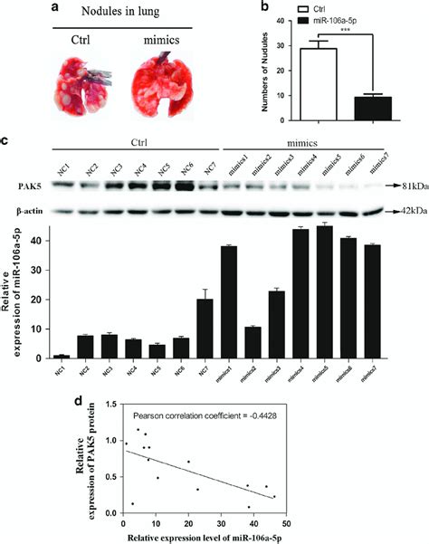 Mir 106a 5p Suppresses Rcc Metastasis In Vivo A Representative