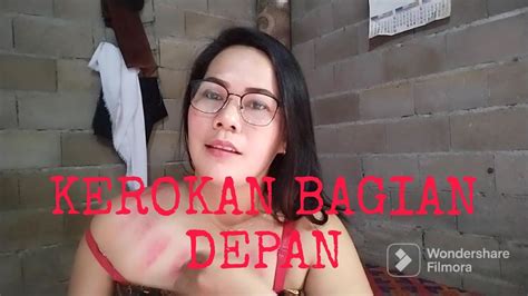 Kerokan Sendiri Bagian Dada Depan Antikaofficial Youtube