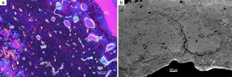 Sample R03 An Adult Of Unknown Sex A Light Micrograph Of Midline And