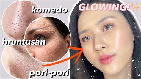 SKINCARE TERBAIK Untuk Bruntusan Jerawat Pori Pori Besar Komedo