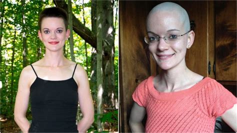 Pin By Ashley Boasso On Before And After Extreme Haircut Pix In 2024