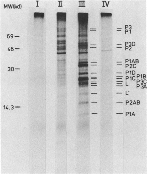 Sds Polyacrylamide Gel Electrophoresis Of Proteins From Virus Infected