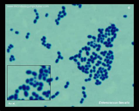 Enterococcus faecalis micrograph. Gram staining technique. Gram stained ...