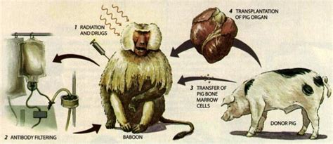 Animal Organs For Human Transplantation How Close Are We
