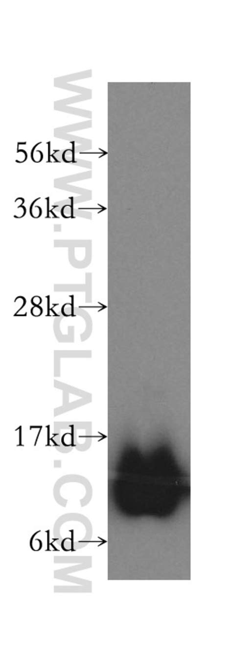 Dnajc Rabbit Anti Human Mouse Rat Polyclonal Proteintech L