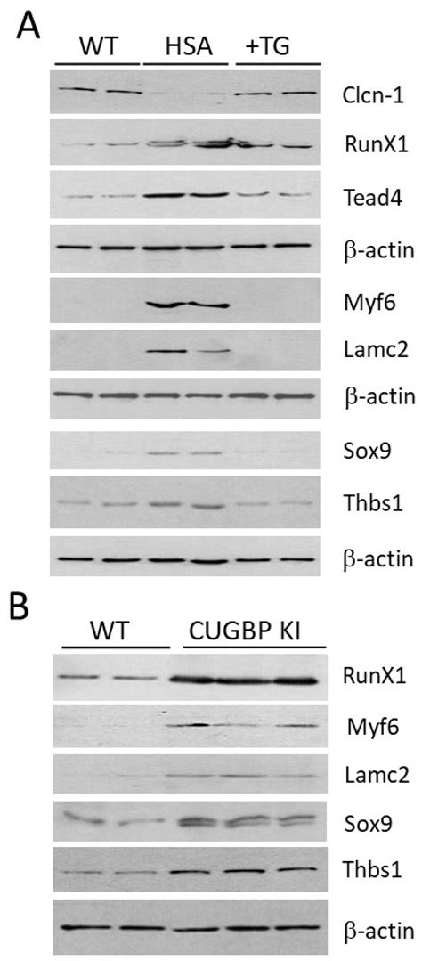 IJMS | Free Full-Text | Therapeutic Targeting of the GSK3β-CUGBP1 ... 