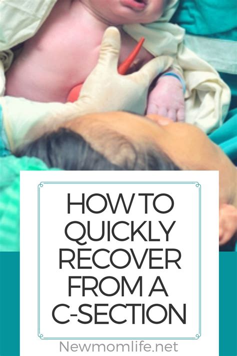 20 C Section Recovery Tips C Section Recovery C Section Recovery