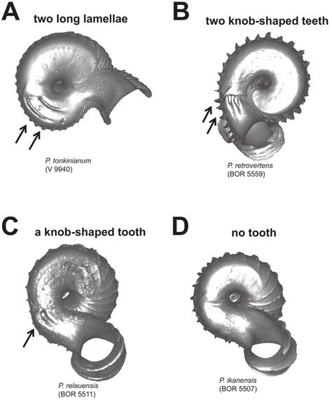 Different Types Of Parietal Constriction Teeth Before The Operculum