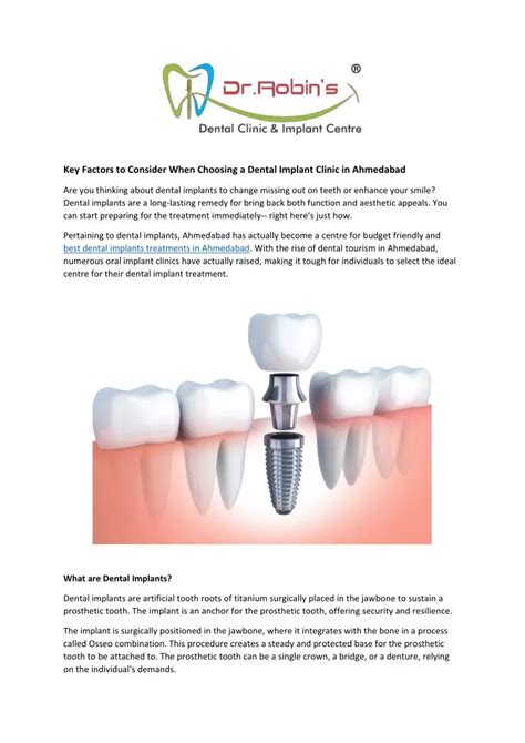 PPT Key Factors To Consider When Choosing A Dental Implant Clinic In