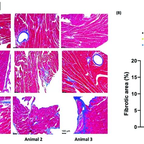 Myocardial Fibrosis At 660 Days Post IR Transverse Sections Of Hearts