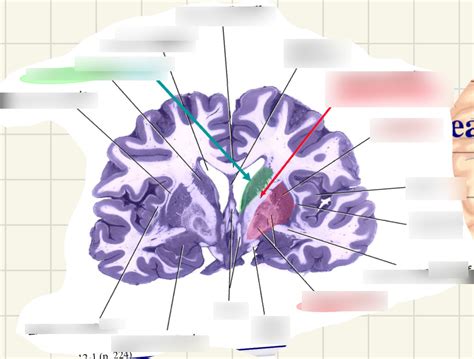 Diagram Of Anterior Cross Section Of Basal Ganglia Quizlet