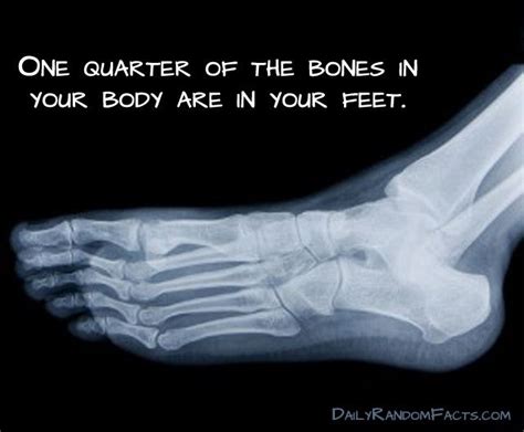 Artrose in voet symptomen behandeling oefeningen – Artofit 