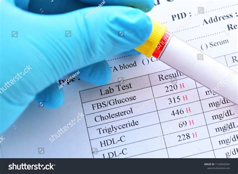 Abnormal High Results Lipid Profile Blood Stock Photo 1129463504