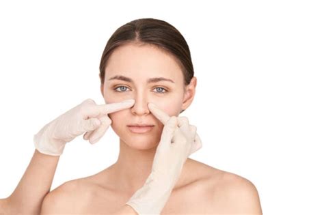 La Evolución De La Rinoplastia