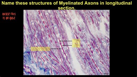 Name these structures of Myelinated Axons in longitudinal section ...