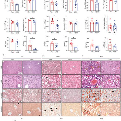 Liver Specific Knockout Of Sptbn1 Protects Mice From Hfd Induced