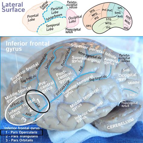 Neuroanatomy Glossary Inferior Frontal Gyrus Opercular Part Draw It