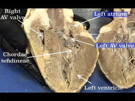 Anterior View Of Sheep Heart Labeled Home Alqu