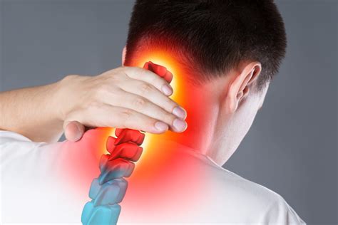 Cervical Spondylosis Causes And Symptoms How To Cure Cervical