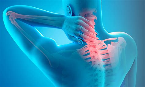 Symptoms of Bulging Disc in Neck C5-C6: Performance Pain and Sports ...