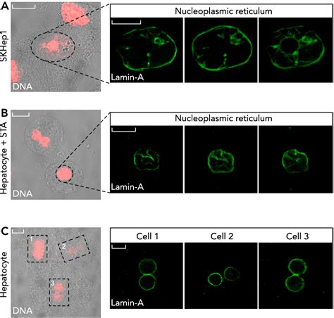 Figure From Decoding Calcium Signaling Across The Nucleus Semantic