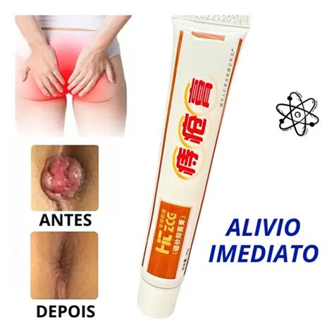 Pomada Em Gel Para Hemorróidas Melhor Que Aliviozon Ozônio