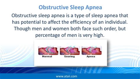 Ppt Obstructive Sleep Apnea Powerpoint Presentation Free Download