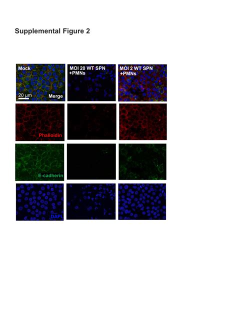 Pore Forming Activity Of S Pneumoniae Pneumolysin Disrupts The