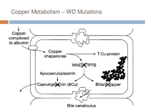 Wilson Disease