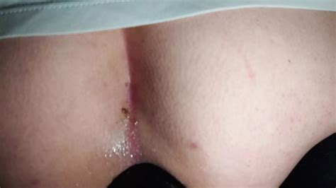 Fuck Ass Gay Porn Videos Sex Model Nudes XHamster