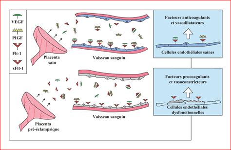 Jle Sang Thrombose Vaisseaux Pré éclampsie Maladie Vasculaire Majeure Physiopathologie