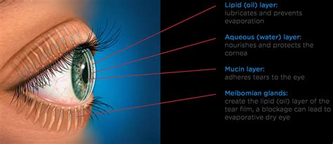 Tear Film Health Is Essential For People With Keratoconus Discovery