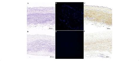 Histological Characterization Of Fresh And Decellularized Human