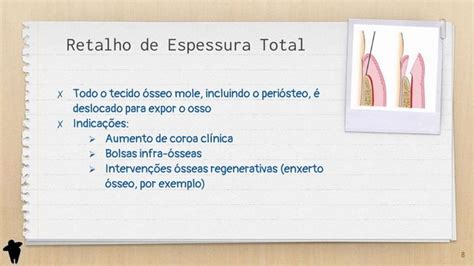 Resumo De Periodontia Classificação Dos Retalhos Periodontais Parte 2