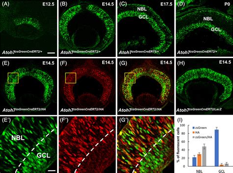 Two New Genetically Modified Mouse Alleles Labeling Distinct Phases Of