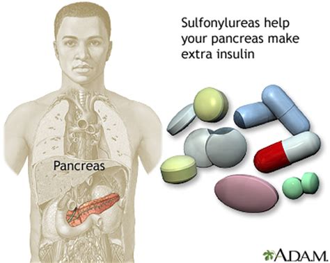 Sulfonylureas drug: MedlinePlus Medical Encyclopedia Image