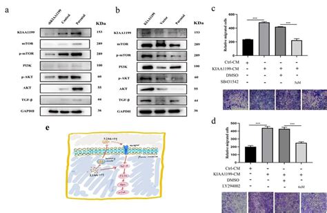 The Expression Of Kiaa1199 And Tgf β Pi3k Akt Pathway Associated