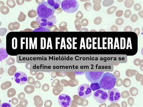 A classificação como fase acelerada da LMC não existe mais Hemoclass