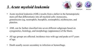 Leukemia Ppt