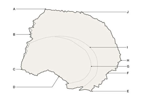 Parietal bone external Diagram | Quizlet